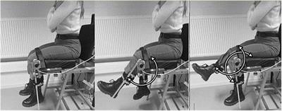 Interlimb Coordination Performance in Seated Position in Persons With Multiple Sclerosis: Reduced Amplitude Over 6 min and Higher Coordination Variability in Persons With Walking Fatigability